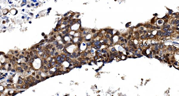 Anti-TBP-1/PSMC3 Antibody
