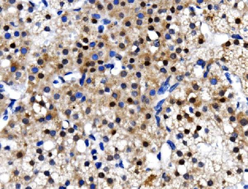 Anti-TBP-1/PSMC3 Antibody