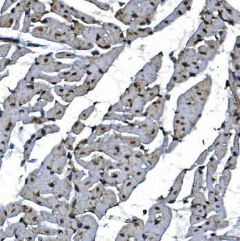 Anti-TBP-1/PSMC3 Antibody