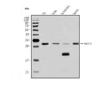 Anti-SOCS3 Antibody
