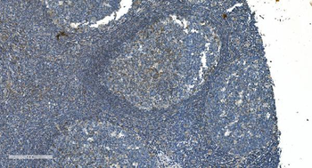 Anti-TIMM8A/DDP Antibody