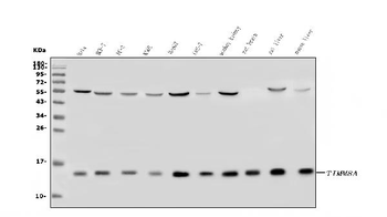 Anti-TIMM8A/DDP Antibody