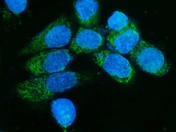 Anti-TIMM8A/DDP Antibody
