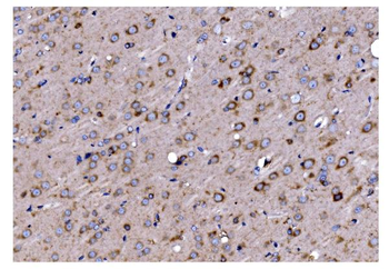 Anti-TIMM8A/DDP Antibody