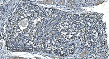 Anti-TIMM8A/DDP Antibody