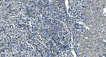 Anti-TIMM8A/DDP Antibody