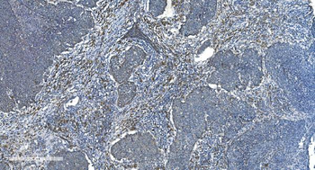 Anti-TIMM8A/DDP Antibody