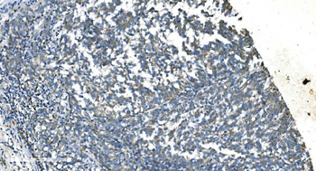 Anti-TIMM8A/DDP Antibody
