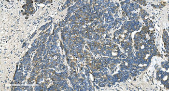 Anti-TIMM8A/DDP Antibody