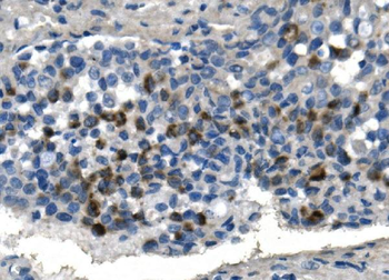 Anti-TMPRSS3 Antibody