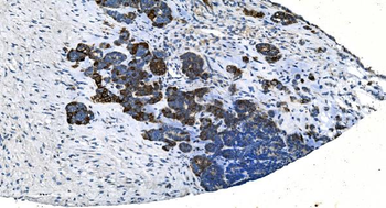 Anti-TMPRSS3 Antibody