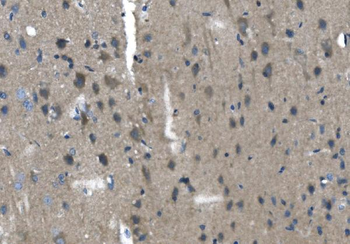 Anti-TMPRSS3 Antibody