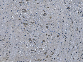 Anti-TMPRSS3 Antibody