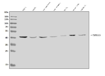 Anti-TMPRSS3 Antibody