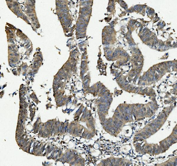 Anti-ANAPC2 Antibody