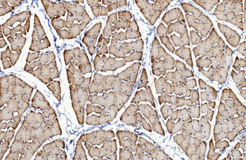 Anti-CACNA1S Antibody