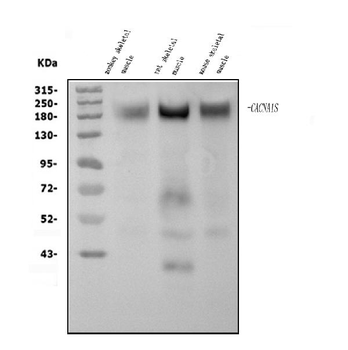 Anti-CACNA1S Antibody