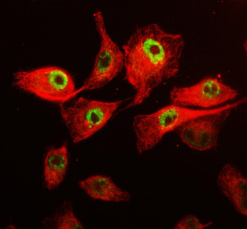 Anti-CDK12 Antibody