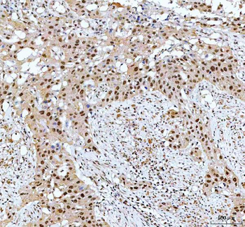 Anti-CDK12 Antibody