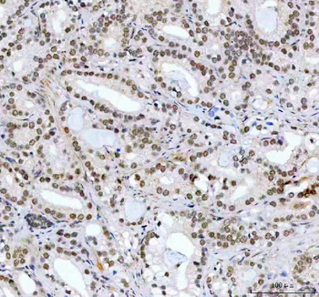 Anti-CDK12 Antibody