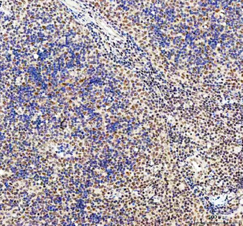 Anti-CDK12 Antibody