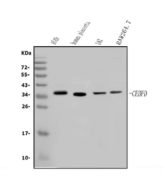 Anti-CEBP Delta/CEBPD Antibody