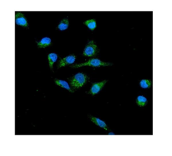 Anti-NOX2/gp91phox/CYBB Antibody