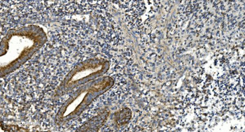 Anti-NOX2/gp91phox/CYBB Antibody