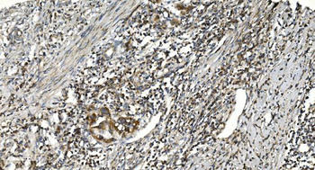 Anti-NOX2/gp91phox/CYBB Antibody