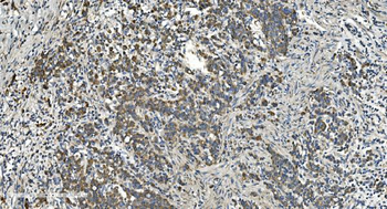 Anti-NOX2/gp91phox/CYBB Antibody