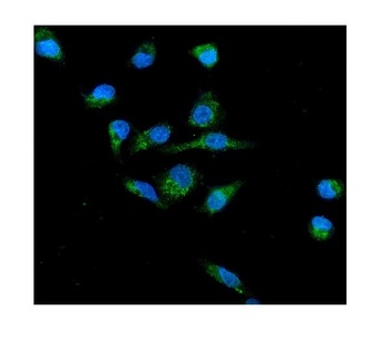 NOX2/gp91phox/CYBB Antibody