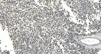 Anti-NOX2/gp91phox/CYBB Antibody
