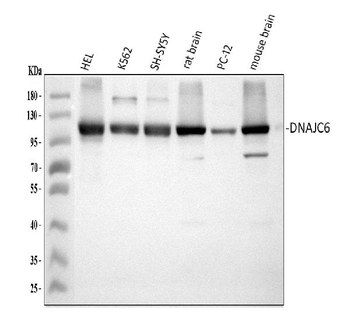 Anti-DNAJC6 Antibody