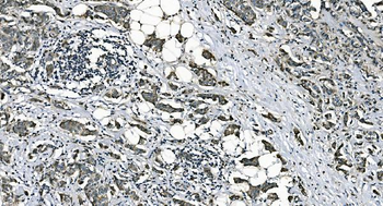 Anti-DNAJC10 Antibody