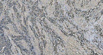 Anti-DNAJC10 Antibody