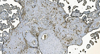 Anti-DNAJC10 Antibody