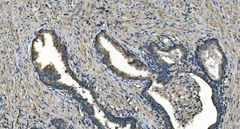 Anti-DNAJC10 Antibody