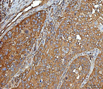 Anti-EEF2 Antibody