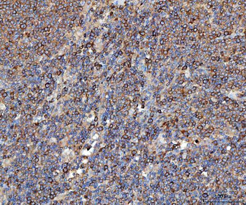 Anti-EEF2 Antibody
