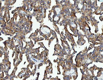 Anti-EEF2 Antibody