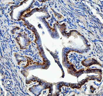 Anti-EEF2 Antibody