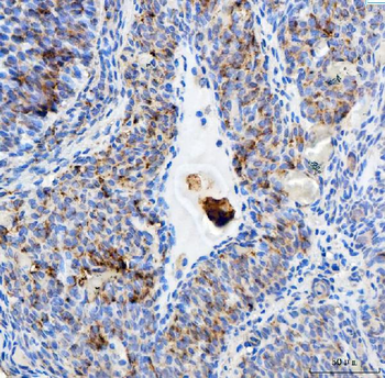 Anti-EEF2 Antibody