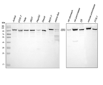 Anti-EEF2 Antibody