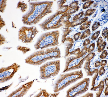 EpCAM Antibody