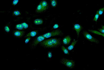 Anti-FEZF1 Antibody