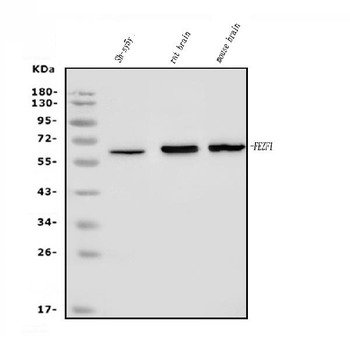 Anti-FEZF1 Antibody