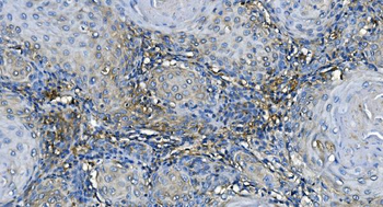 Anti-GABARAP Antibody