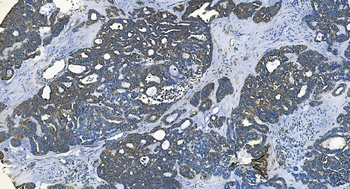 Anti-GABARAP Antibody