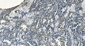 Anti-GABARAP Antibody