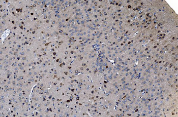 Anti-GABARAP Antibody